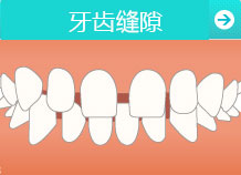 牙�X稀疏的原因有哪些