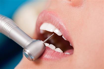 定期洗牙能否�A防疾病