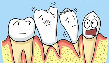 引起牙周炎的原因有哪些