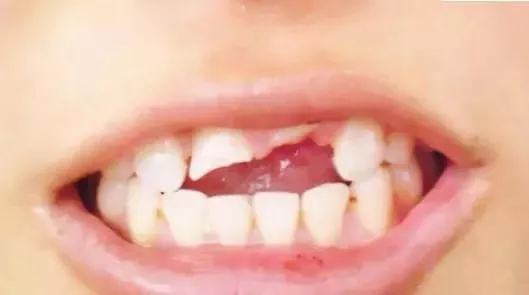 �a牙